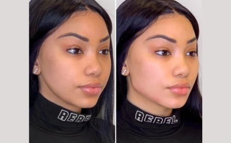 Best Doctors in Dubai for Thread Lift: How to Restore Skin Tightness and Firmness Non-Surgically