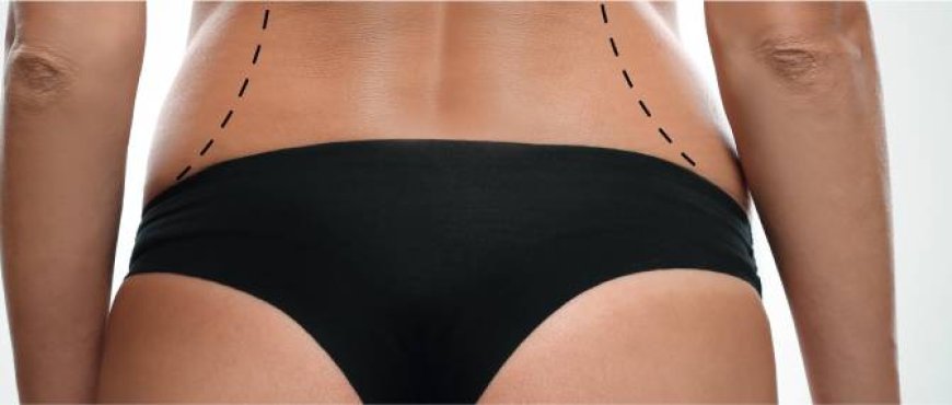 Body Contouring in Dubai: Transform Your Shape with Customized Aesthetic Solutions