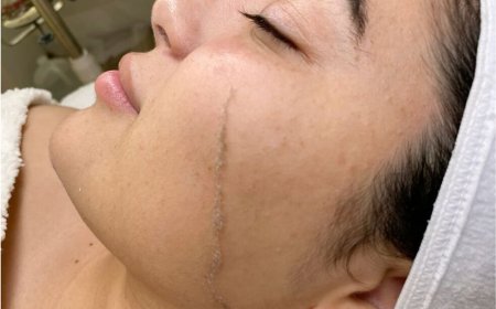 Top Skin Treatments in Euless, TX: A Guide to Radiant, Healthy Skin