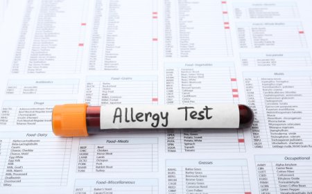 Allergy Testing in London: A Complete Guide for Diagnosis and Relief