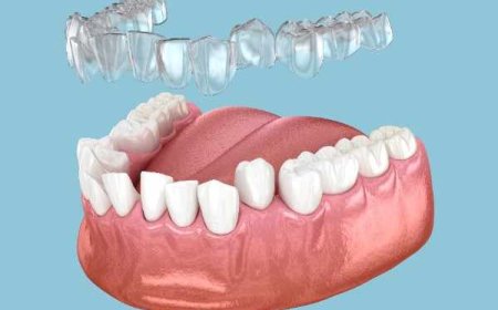 Identifying Teeth That Are More Difficult to Move with Invisalign