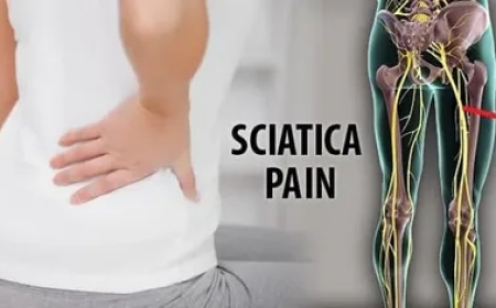 Understanding Sciatica and Its Treatments: A Guide