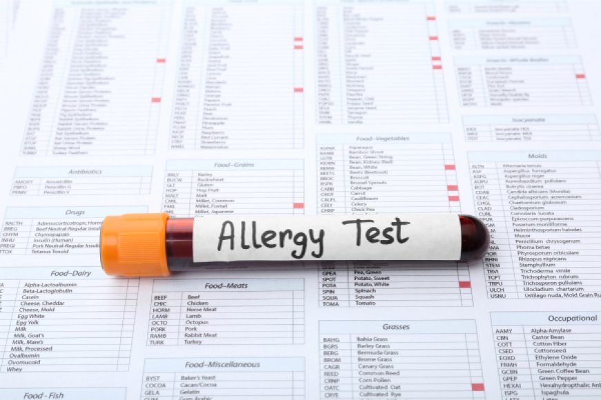 Allergy Testing in London: A Complete Guide for Diagnosis and Relief